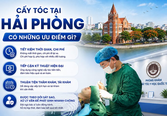 Cấy tóc tại Hải Phòng có những ưu điểm gì? 4 lợi thế cần biết