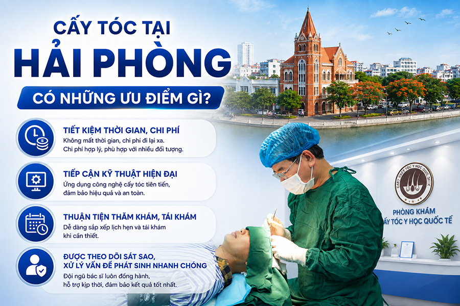 Cấy tóc tại Hải Phòng có những ưu điểm gì? 4 lợi thế cần biết