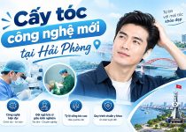 Cấy tóc công nghệ mới tại Hải Phòng