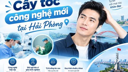 Cấy tóc công nghệ mới tại Hải Phòng