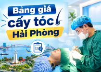 Tìm hiểu chi tiết : Bảng giá cấy tóc Hải Phòng