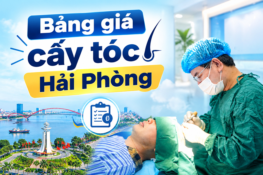 Bảng giá cấy tóc Hải Phòng: Chi phí bao nhiêu, tính theo tiêu chí nào?