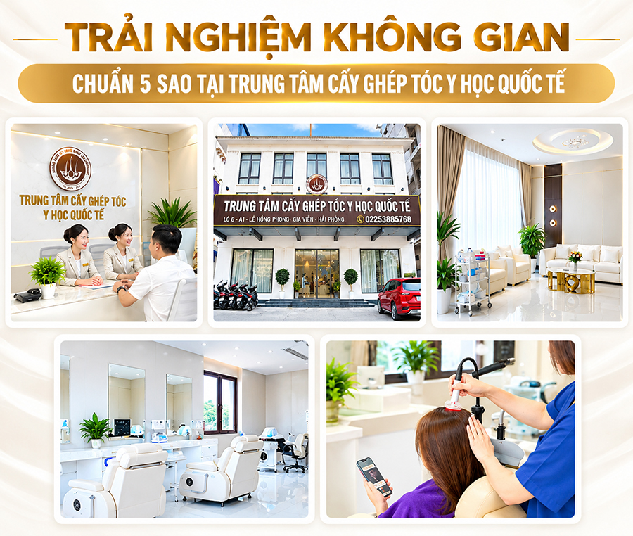 trung tâm cấy ghép tóc y học quốc tế Hải Phòng