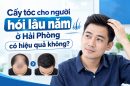 Cấy tóc cho người hói lâu năm ở Hải Phòng có hiệu quả không?