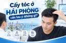 Cấy tóc ở Hải Phòng cần lưu ý những gì?