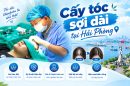 Cấy tóc sợi dài tại Hải Phòng: Nguyên lý, ưu điểm và chi phí