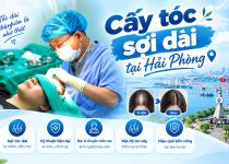 Cấy tóc sợi dài tại Hải Phòng: Nguyên lý, ưu điểm và chi phí