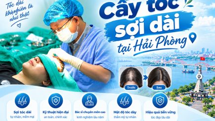 Cấy tóc sợi dài tại Hải Phòng: Nguyên lý, ưu điểm và chi phí