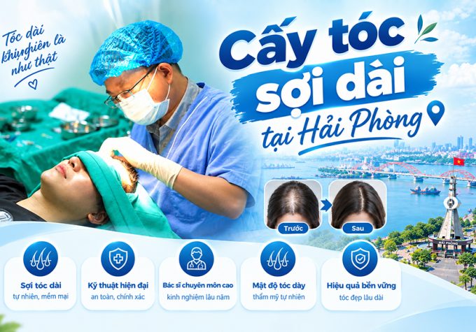 Cấy tóc sợi dài tại Hải Phòng: Nguyên lý, ưu điểm và chi phí