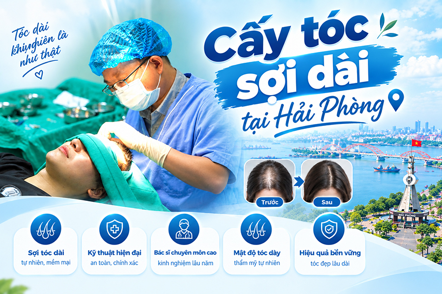 Cấy tóc sợi dài tại Hải Phòng: Nguyên lý, ưu điểm và chi phí