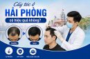 Cấy tóc ở Hải Phòng có hiệu quả không? Đánh giá thực tế