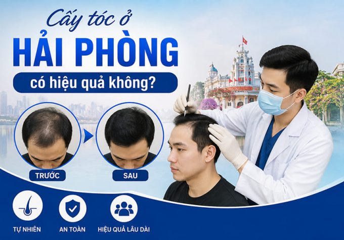 Cấy tóc ở Hải Phòng có hiệu quả không? Đánh giá thực tế
