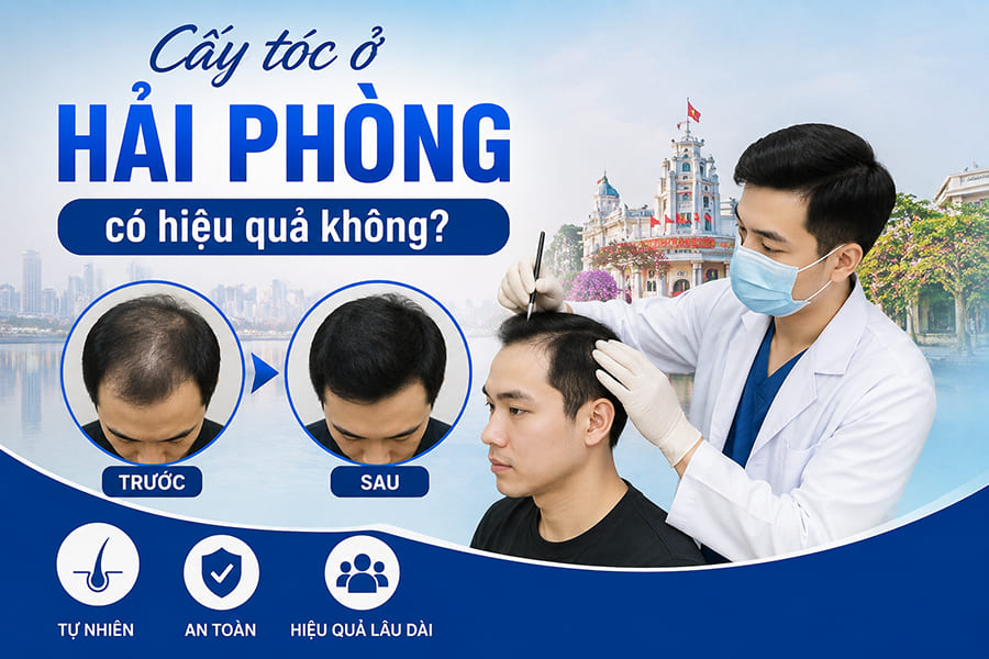Cấy tóc ở Hải Phòng có hiệu quả không? Đánh giá thực tế