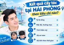 Đánh giá kết quả cấy tóc tại Hải Phòng theo tiêu chí nào