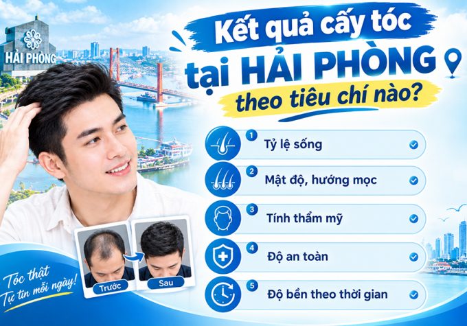 Đánh giá kết quả cấy tóc tại Hải Phòng theo tiêu chí nào? Trải nghiệm thực tế