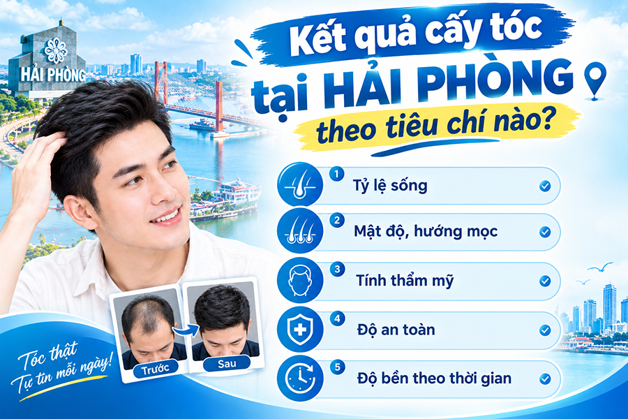 Đánh giá kết quả cấy tóc tại Hải Phòng theo tiêu chí nào? Trải nghiệm thực tế