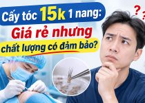 Cấy tóc 15k 1 nang Giá rẻ nhưng chất lượng có đảm bảo