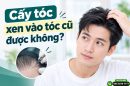 Cấy tóc xen vào tóc cũ được không? Khi nào nên làm, khi nào cần cân nhắc?