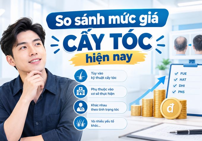 So sánh mức giá cấy tóc hiện nay: Chênh lệch vài chục triệu do đâu?