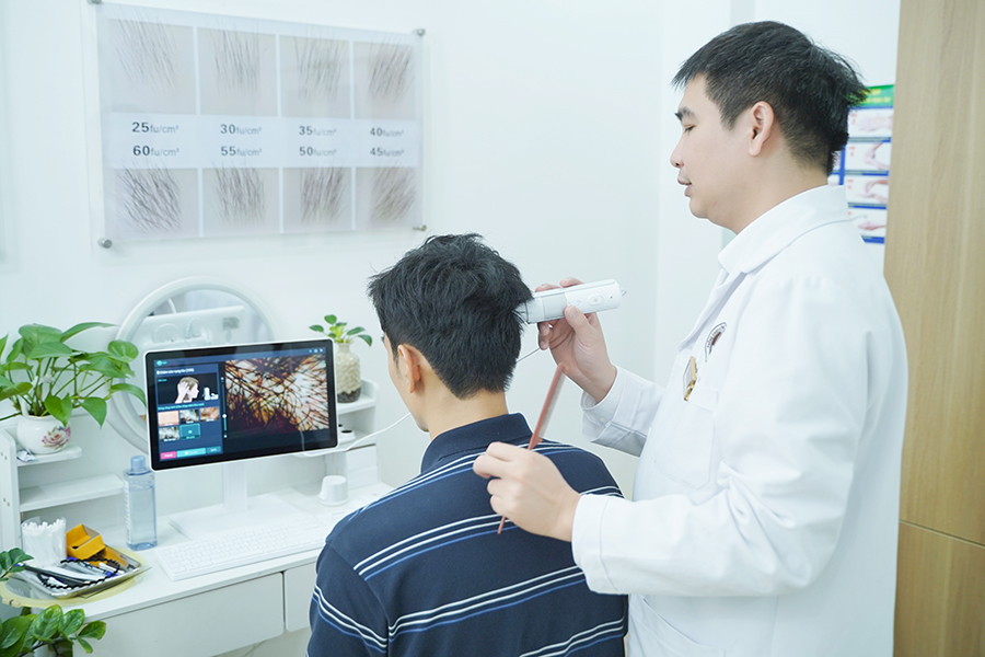 Cấy tóc FUE vs cấy tóc HAT