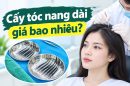 Cấy tóc nang dài giá bao nhiêu? Chi phí thực tế và lưu ý trước khi thực hiện