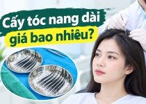 Cấy tóc nang dài giá bao nhiêu?