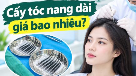 Cấy tóc nang dài giá bao nhiêu?