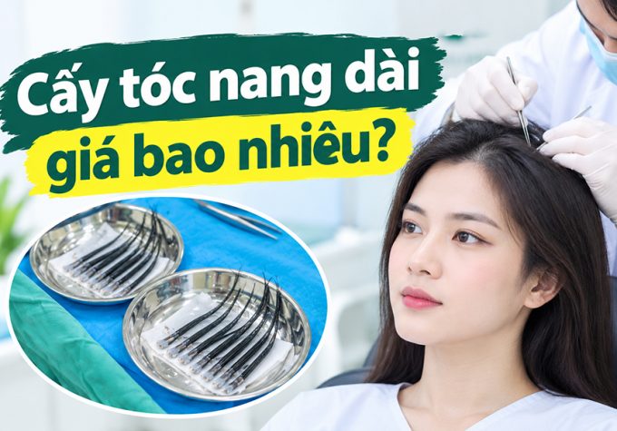 Cấy tóc nang dài giá bao nhiêu? Chi phí thực tế và lưu ý trước khi thực hiện