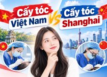 So sánh chi tiết : Cấy tóc Việt Nam vs cấy tóc Shanghai