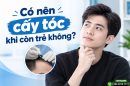 Có nên cấy tóc khi còn trẻ không? Đánh giá chuyên môn