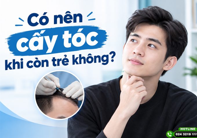 Có nên cấy tóc khi còn trẻ không? Đánh giá chuyên môn