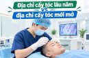 Địa chỉ cấy tóc lâu năm vs địa chỉ cấy tóc mới mở: Khác biệt nào quyết định kết quả?