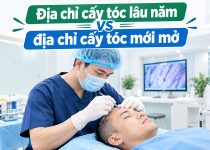 so sánh địa chỉ cấy tóc lâu năm vs địa chỉ cấy tóc mới mở