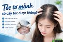 Tóc tơ mảnh có cấy tóc được không? Phân tích từ chuyên gia