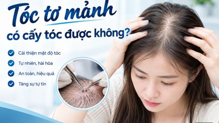 tóc tơ mảnh có cấy tóc được không