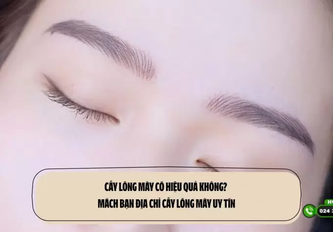 Cấy lông mày có hiệu quả không? Mách bạn địa chỉ cấy lông mày uy tín