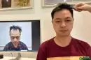 Review chi tiết hành trình cấy tóc 6 tháng: Có đáng để đầu tư?