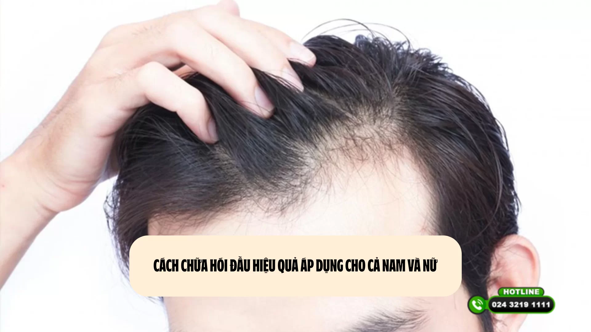 Cách chữa hói đầu hiệu quả áp dụng cho cả nam và nữ