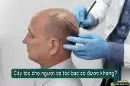 Góc tư vấn: Cấy tóc cho người có tóc bạc có được không?