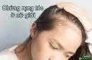 Chứng rụng tóc ở nữ giới: Những điều bạn nên biết