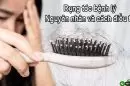 Rụng tóc bệnh lý: Nguyên nhân và cách điều trị
