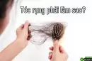Tóc rụng phải làm sao? Những giải pháp khắc phục hiệu quả