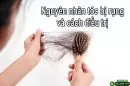 Nguyên nhân tóc bị rụng và cách điều trị – Bạn đã biết!